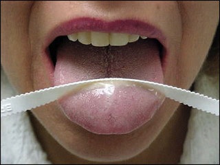 La lengua en la higiene oral 