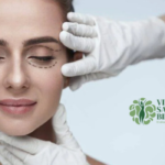 La Blefaroplastia